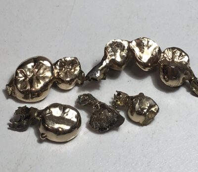 金歯一式　をまとめてお買取りさせていただきました！