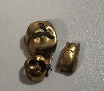 金歯一式　をお買取りさせていただきました！
